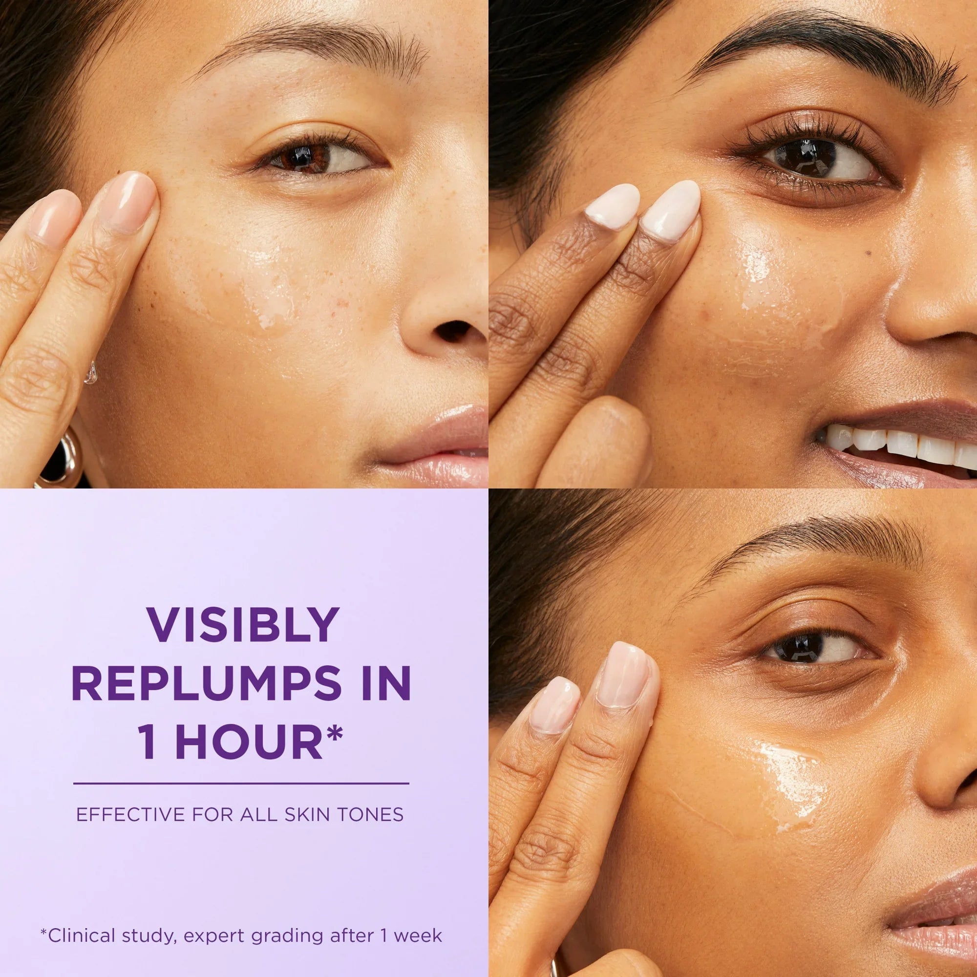 L'Oreal Paris Revitalift Derm Intensives Hyaluronic Acid Face Serum, Anti-Aging, 1.0 fl oz