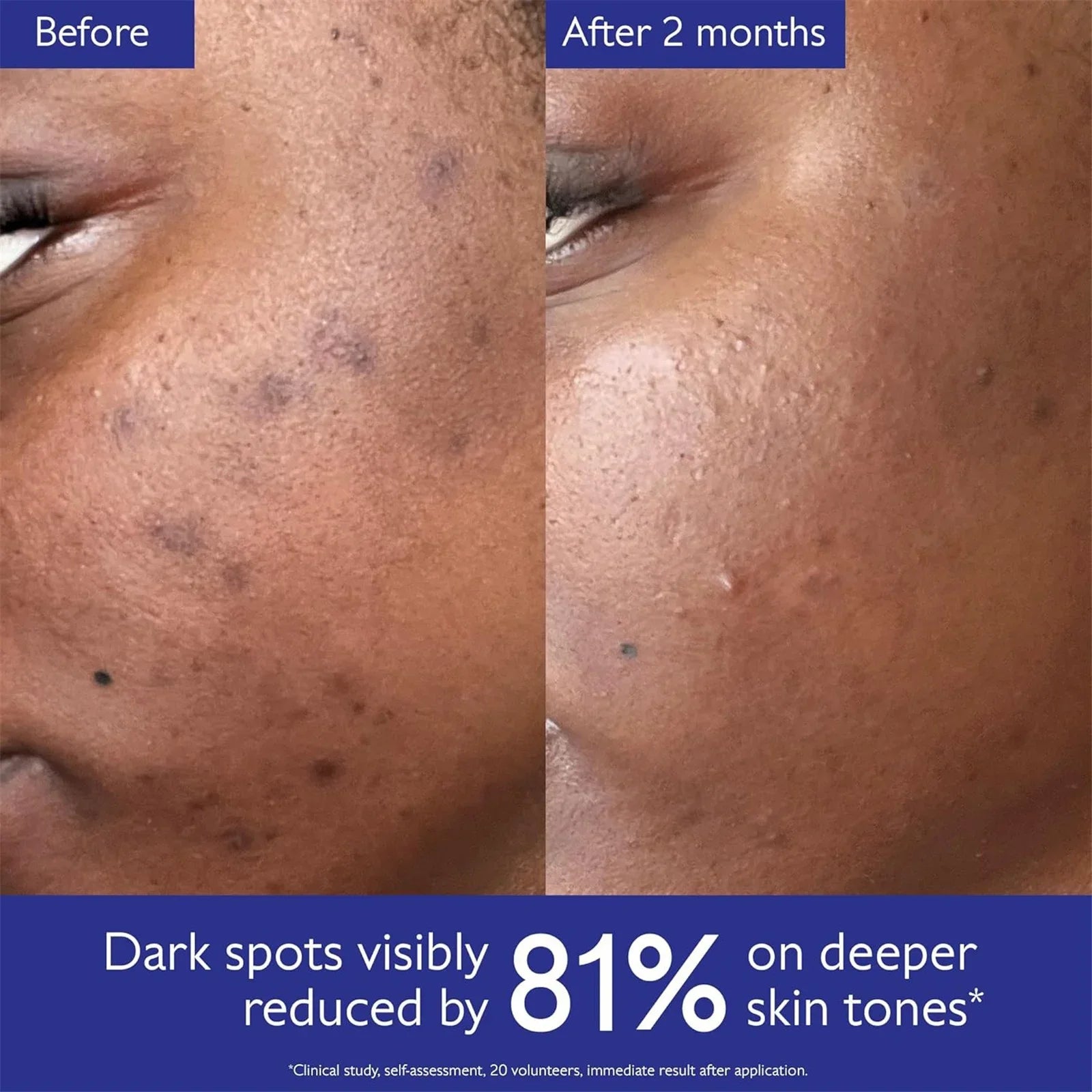 Dark Spot Brightening Serum Vitamin C Alternative - 50ml